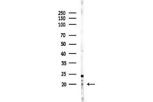 Western blot analysis of lysates from HepG2 cells(heat-shock,45 min treatment), using NDUFS7 Antibody at 1/1000 dilution.