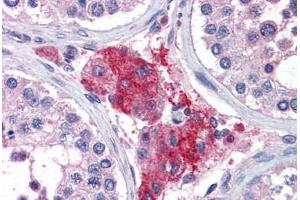 Human Testis (formalin-fixed, paraffin-embedded) stained with ACYP1 antibody ABIN351487 at 3. (ACYP1 Antikörper  (AA 72-85))