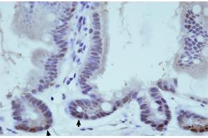 Immunohistochemistry (IHC) image for anti-THO Complex 1 (THOC1) (C-Term) antibody (ABIN2778931)