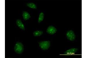 Immunofluorescence of purified MaxPab rabbit antibody to IL16 on HeLa cell. (IL16 Antikörper  (AA 1-454))