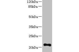 Western blot All lanes: TTC9C antibody at 12 μg/mL + THP-1 whole cell lysate Secondary Goat polyclonal to rabbit IgG at 1/10000 dilution Predicted band size: 21, 25 kDa Observed band size: 21 kDa (TTC9C Antikörper  (AA 1-171))