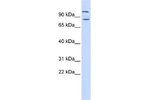 DAGLB antibody used at 1 ug/ml to detect target protein. (DAGLB Antikörper  (Middle Region))