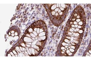 ABIN6272883 at 1/100 staining Mouse colon tissue by IHC-P. (TMEM67 Antikörper  (Internal Region))