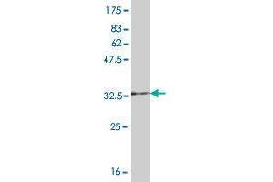 Western Blot detection against Immunogen (36. (UBE2D1 Antikörper  (AA 1-94))