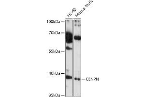 Western blot analysis of extracts of various cell lines, using CENPN antibody (ABIN7266276) at 1:1000 dilution. (CENPN Antikörper  (AA 180-300))