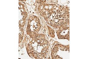 (ABIN392786 and ABIN2842224) staining PFKFB4 in human testis tissue sections by Immunohistochemistry (IHC-P - paraformaldehyde-fixed, paraffin-embedded sections). (PFKFB4 Antikörper  (AA 266-296))