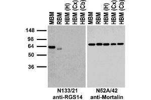Immunoblot against crude membranes from whole mouse (MBM) or rat (RBM) brain and from human hippocampus [HBM(H)], cerebral cortex [HBM(Cx)] or cerebellum [HBM(Cb)] probed with N133/21 (left) or N52A/42 (right) TC supe.