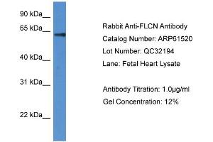 Western Blotting (WB) image for anti-Folliculin (FLCN) (N-Term) antibody (ABIN2788829)