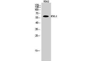 Western Blotting (WB) image for anti-Potassium Voltage-Gated Channel, Shaw-Related Subfamily, Member 1 (KCNC1) (Internal Region) antibody (ABIN3185333)