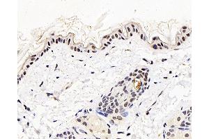 Immunohistochemistry analysis of paraffin-embedded mouse skin using MGMT Polyclonal Antibody at dilution of 1:300. (MGMT Antikörper)