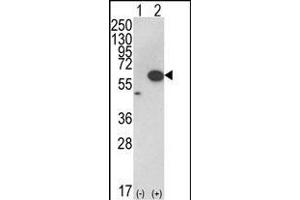 Western blot analysis of AKT1 (arrow) using rabbit polyclonal hAKT1- (ABIN652283 and ABIN2841190). (AKT1 Antikörper  (C-Term))