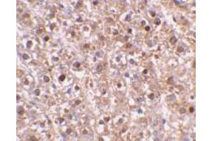 Immunohistochemistry (Paraffin-embedded Sections) (IHC (p)) image for anti-Caspase 12 (Gene/pseudogene) (CASP12) (Intermediate Domain) antibody (ABIN499549)