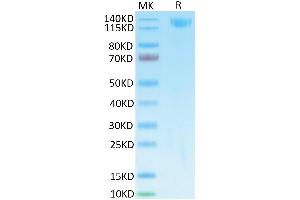 SARS Spike S1 on Tris-Bis PAGE under reduced condition. (SARS-CoV-2 Spike S1 Protein (Fc-Avi Tag))