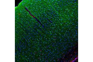 Image no. 1 for anti-Chemokine (C-C Motif) Ligand 5 (CCL5) antibody (ABIN465616) (CCL5 Antikörper)