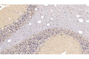 Detection of SIGLEC10 in Human Cerebellum Tissue using Monoclonal Antibody to Sialic Acid Binding Ig Like Lectin 10 (SIGLEC10) (SIGLEC10 Antikörper  (AA 571-697))