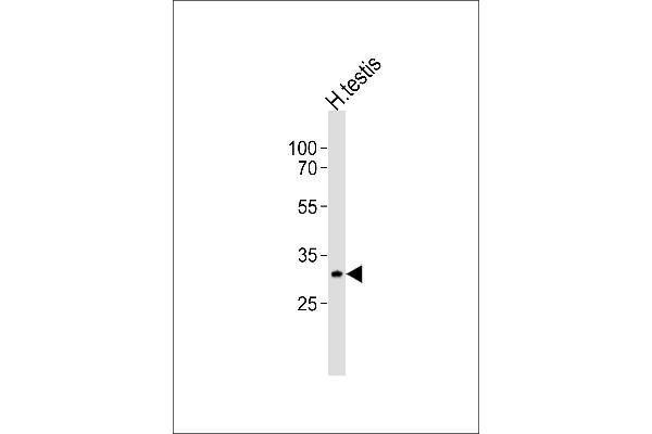 SYCP3 Antikörper  (N-Term)