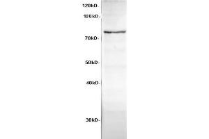 Western Blot analysis of HeLa cells using Cadherin-8 Polyclonal Antibody at dilution of 1:600 (Cadherin 8 Antikörper)