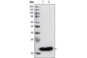 Western Blotting (WB) image for anti-Glutathione S-Transferase pi 1 (GSTP1) antibody (ABIN2983291) (GSTP1 Antikörper)