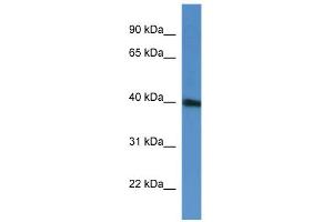 WB Suggested Anti-PRPF38A Antibody Titration: 0. (PRPF38A Antikörper  (C-Term))
