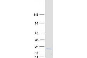 Western Blotting (WB) image for Vesicle-Associated Membrane Protein 1 (Synaptobrevin 1) (VAMP1) (Transcript Variant 1) protein (Myc-DYKDDDDK Tag) (ABIN2735163)