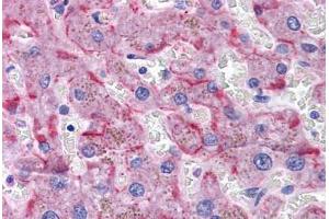 Human Liver: Formalin-Fixed, Paraffin-Embedded (FFPE) (SORBS1 Antikörper  (AA 300-313))
