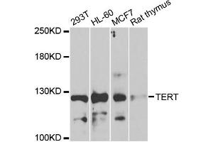 Western Blotting (WB) image for anti-Telomerase Reverse Transcriptase (TERT) antibody (ABIN1875058)