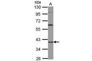 Image no. 1 for anti-Heterogeneous Nuclear Ribonucleoprotein D (HNRNPD) (AA 18-225) antibody (ABIN1498704) (HNRNPD/AUF1 Antikörper  (AA 18-225))