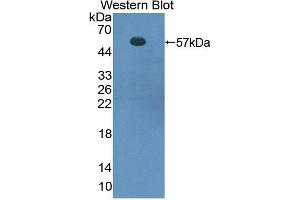 Western blot analysis of the recombinant protein. (FOXP3 Antikörper  (AA 190-412))