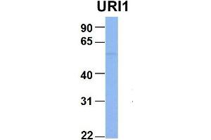 Host:  Rabbit  Target Name:  URI1  Sample Type:  MCF7  Antibody Dilution:  1. (URI1 Antikörper  (Middle Region))
