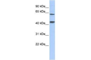 WB Suggested Anti-KLHL8 Antibody Titration:  0. (KLHL8 Antikörper  (Middle Region))