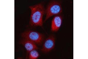 IF analysis of MTAP using anti-MTAP antibody (ABIN7601258). (MTAP Antikörper  (AA 31-283))