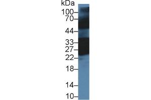 Detection of CRYbB1 in Mouse Eye lysate using Polyclonal Antibody to Crystallin Beta B1 (CRYbB1) (CRYBB1 Antikörper  (AA 6-186))