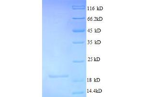 SDS-PAGE (SDS) image for Chromosome 4 Open Reading Frame 3 (C4ORF3) (AA 1-44), (partial) protein (His-SUMO Tag) (ABIN5711549) (C4ORF3 Protein (AA 1-44, partial) (His-SUMO Tag))