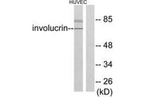 Western blot analysis of extracts from HuvEc cells, using Involucrin Antibody. (Involucrin Antikörper  (AA 536-585))