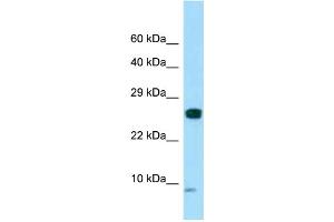 WB Suggested Anti-SPANXC Antibody Titration: 1.