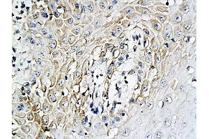 Antigen: 2 µg/100 µL  Primary: Antiserum, 1:500, 1:1000, 1:2000, 1:4000, 1:8000, 1:16000, 1:32000;  Secondary: HRP conjugated Rabbit Anti-Goat IgG at 1: 5000;  TMB staining  Read the data in Microplate Reader by 450nm. (IL-6 Antikörper  (AA 110-185))