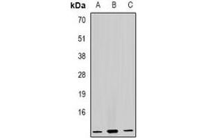 Western blot analysis of GHRH expression in Raji (A), HL60 (B), mouse liver (C) whole cell lysates. (GHRH Antikörper)