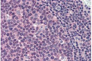 Human Tonsil (formalin-fixed, paraffin-embedded) stained with MCL1 antibody ABIN337283 at 10 ug/ml followed by biotinylated anti-mouse IgG secondary antibody ABIN481714, alkaline phosphatase-streptavidin and chromogen. (MCL-1 Antikörper)