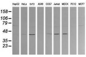 Image no. 1 for anti-Mitogen-Activated Protein Kinase Kinase 1 (MAP2K1) antibody (ABIN1499390) (MEK1 Antikörper)