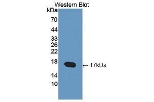 Western Blotting (WB) image for anti-Cartilage Oligomeric Matrix Protein (COMP) (AA 123-240) antibody (ABIN1867326)