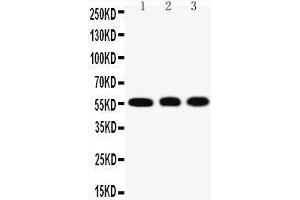 Anti-KLF4 antibody, Western blotting Lane 1: HELA Cell Lysate Lane 2: A549 Cell Lysate Lane 3: U20S Cell Lysate (KLF4 Antikörper  (N-Term))