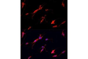 Immunofluorescence analysis of PC12 cells using ENO2 antibody. (ENO2/NSE Antikörper  (AA 195-434))