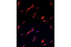 Immunofluorescence analysis of PC12 cells using ENO2 antibody. (ENO2/NSE Antikörper  (AA 195-434))