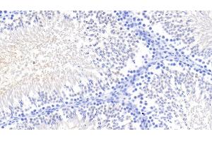 Detection of Kim1 in Rat Testis Tissue using Monoclonal Antibody to Kidney Injury Molecule 1 (Kim1) (HAVCR1 Antikörper  (AA 22-235))