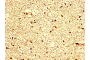 IHC image of ABIN7145183 diluted at 1:300 and staining in paraffin-embedded human brain tissue performed on a Leica BondTM system. (BDKRB2 Antikörper  (AA 336-391))