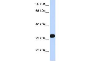 PDGFB antibody used at 1 ug/ml to detect target protein. (PDGFB Antikörper  (N-Term))