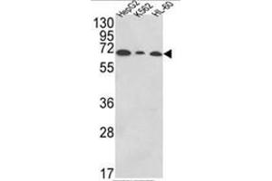 Western blot analysis of PIGR Antibody (C-term) in HepG2,K562,HL-60 cell line lysates (35ug/lane). (PIGR Antikörper  (C-Term))