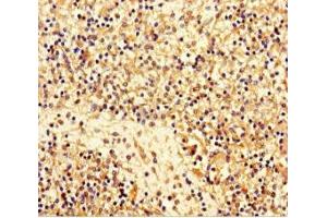 Immunohistochemistry of paraffin-embedded human spleen tissue using ABIN7159348 at dilution of 1:100 (Majin (AA 1-216) Antikörper)