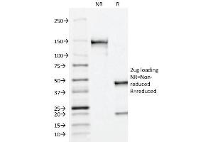 SDS-PAGE Analysis Purified PSAP Mouse Monoclonal Antibody (ACPP/1338). (ACPP Antikörper)