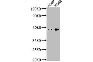 Western Blot Positive WB detected in: A549 whole cell lysate, K562 whole cell lysate All lanes: NKAPL antibody at 1:1000 Secondary Goat polyclonal to rabbit IgG at 1/50000 dilution Predicted band size: 47 kDa Observed band size: 47 kDa (NKAPL Antikörper  (AA 114-123))